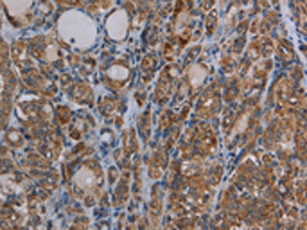 Rabbit Polyclonal Antibody to MYO7A