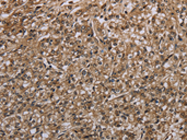 Rabbit Polyclonal Antibody to MYO18B