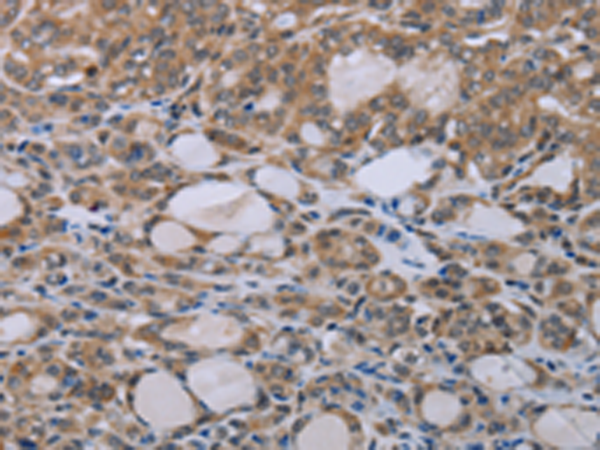 Rabbit Polyclonal Antibody to NAIP
