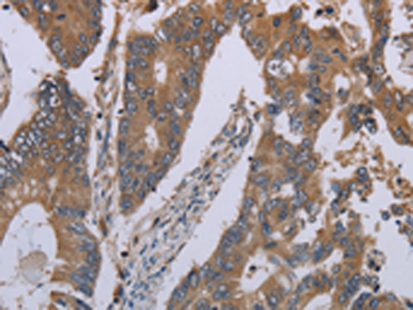 Rabbit Polyclonal Antibody to NLRP12