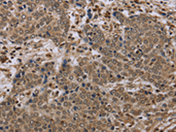 Rabbit Polyclonal Antibody to NLRP4