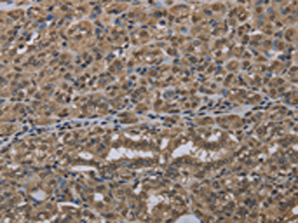 Rabbit Polyclonal Antibody to NLRP6