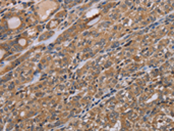 Rabbit Polyclonal Antibody to NAA25