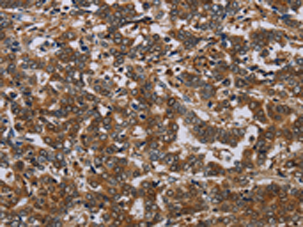 Rabbit Polyclonal Antibody to NCKAP1