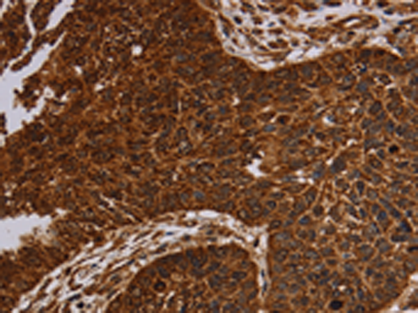 Rabbit Polyclonal Antibody to NDUFAB1