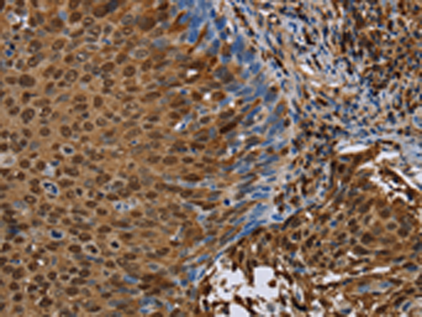 Rabbit Polyclonal Antibody to NRP2