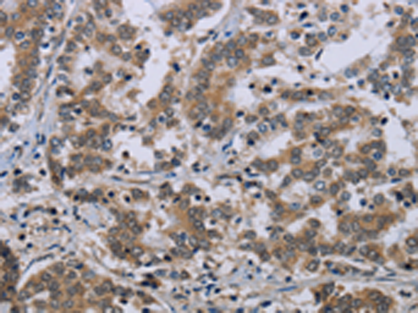 Rabbit Polyclonal Antibody to NEFH