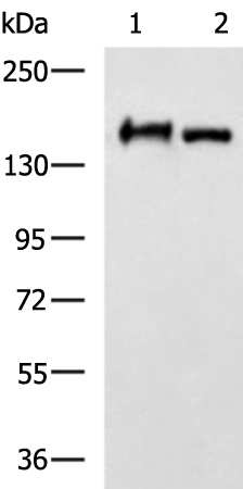 Rabbit Polyclonal Antibody to NEFM