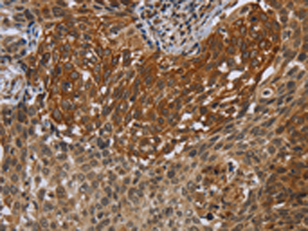 Rabbit Polyclonal Antibody to UHRF2