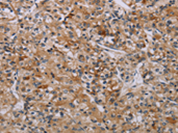Rabbit Polyclonal Antibody to AATK
