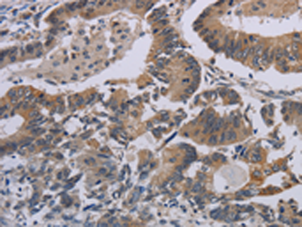 Rabbit Polyclonal Antibody to CCL1