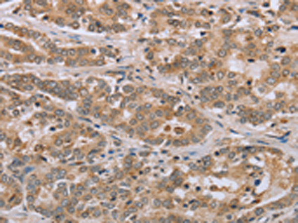Rabbit Polyclonal Antibody to CLEC16A