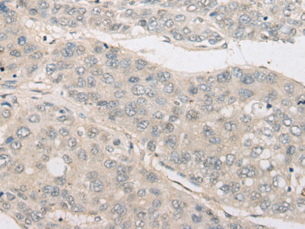 Rabbit Polyclonal Antibody to NLGN1