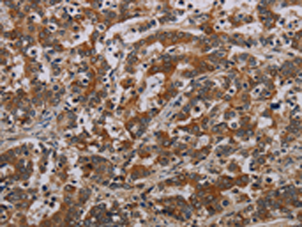 Rabbit Polyclonal Antibody to NLRP9