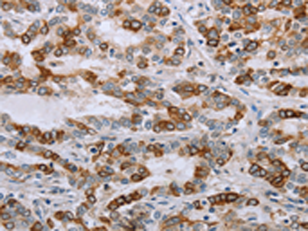 Rabbit Polyclonal Antibody to NMT1