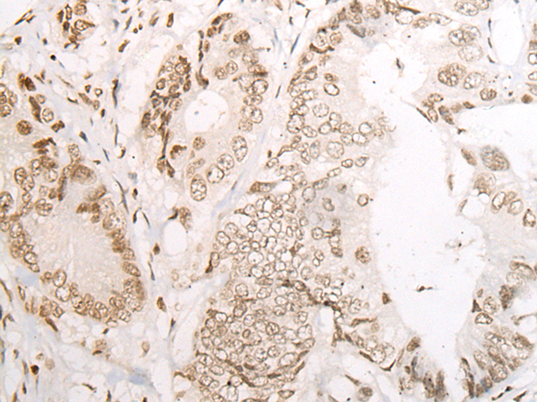 Rabbit Polyclonal Antibody to NOL8