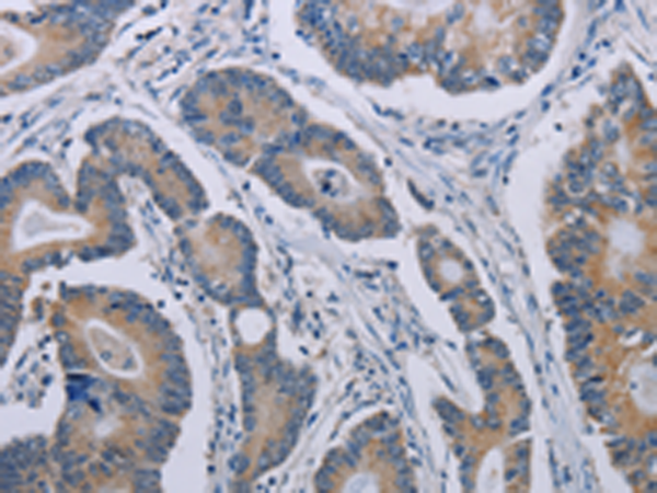 Rabbit Polyclonal Antibody to NOX1