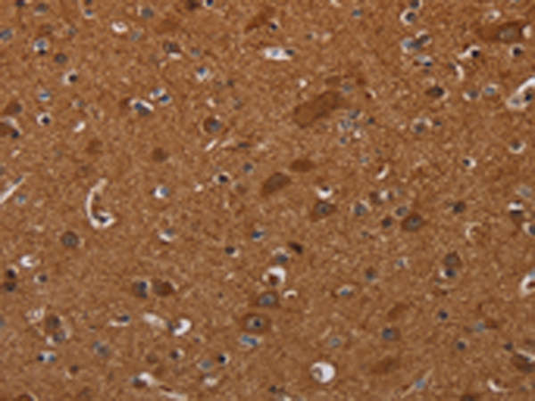 Rabbit Polyclonal Antibody to CYBB