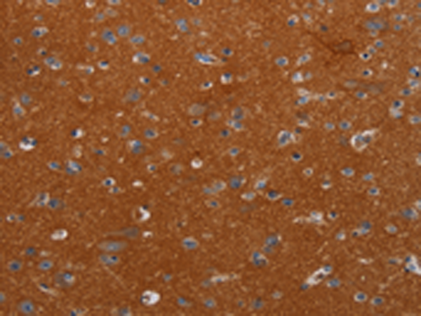 Rabbit Polyclonal Antibody to NOX3