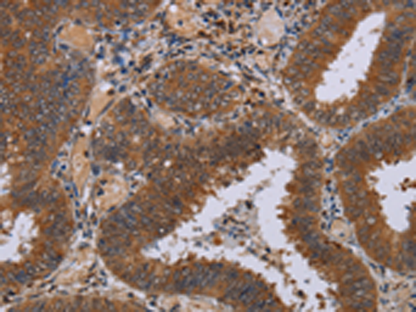 Rabbit Polyclonal Antibody to NPTX1