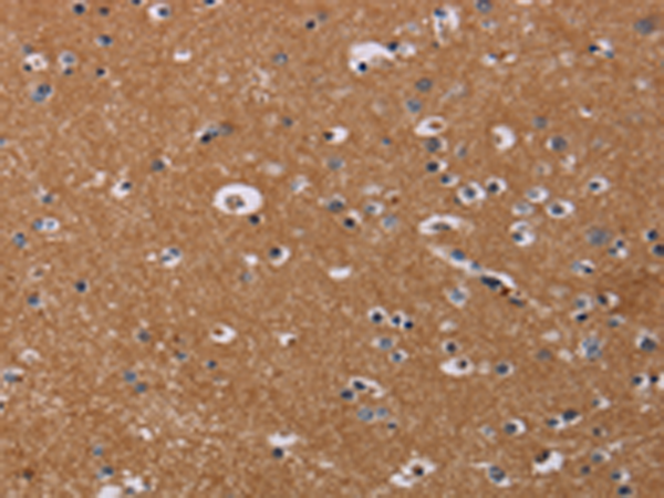 Rabbit Polyclonal Antibody to NRAS