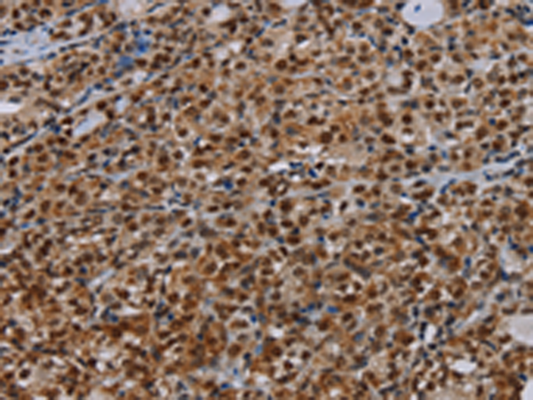 Rabbit Polyclonal Antibody to DCAF6