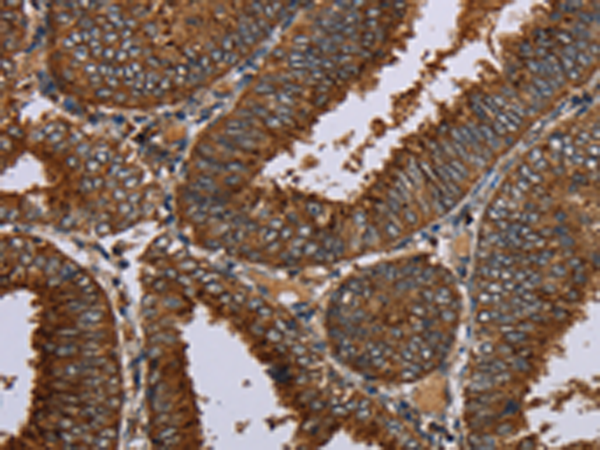 Rabbit Polyclonal Antibody to C12orf75