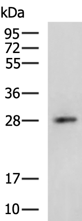 Rabbit Polyclonal Antibody to OSM