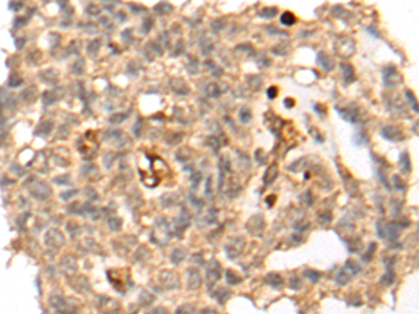 Rabbit Polyclonal Antibody to SP7