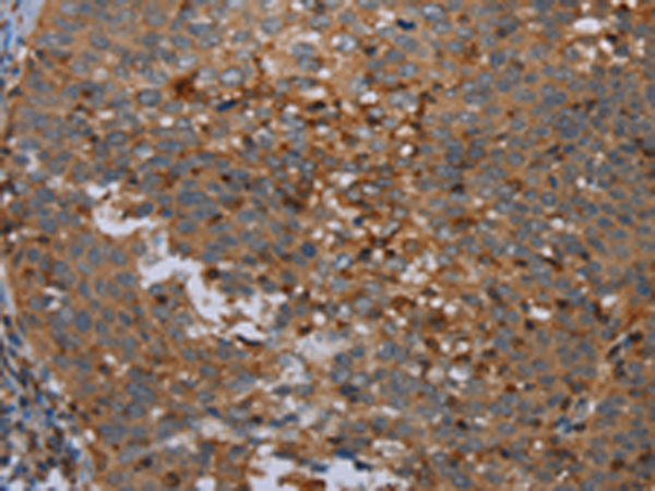 Rabbit Polyclonal Antibody to OTOR