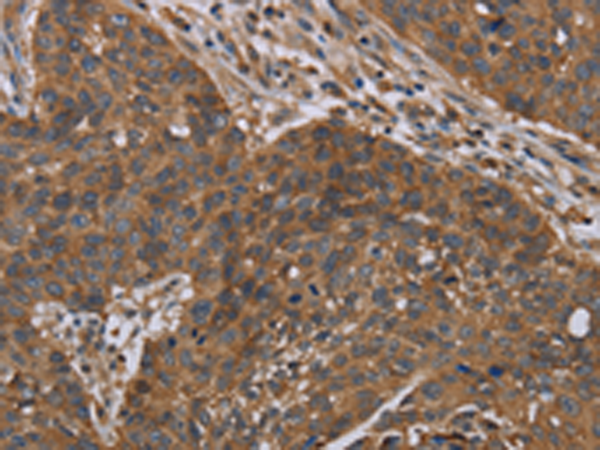 Rabbit Polyclonal Antibody to OXTR