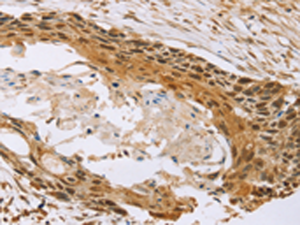 Rabbit Polyclonal Antibody to MED12