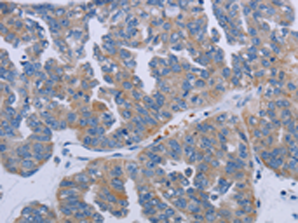 Rabbit Polyclonal Antibody to P2RY2