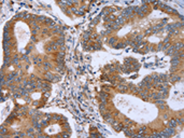 Rabbit Polyclonal Antibody to MMP9