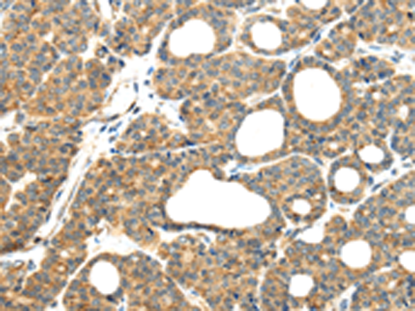 Rabbit Polyclonal Antibody to MMP9