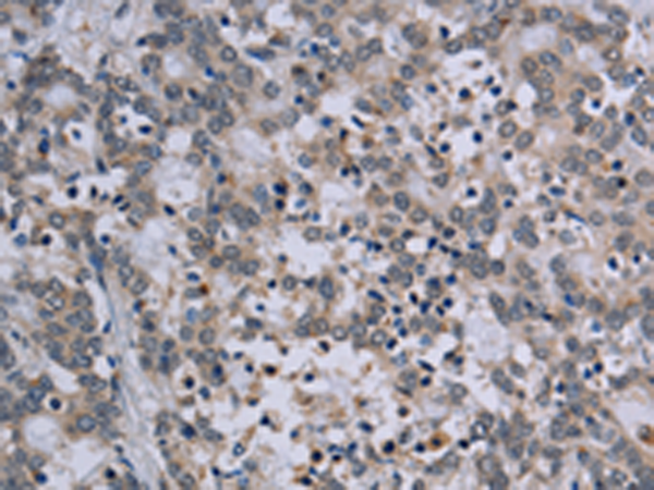 Rabbit Polyclonal Antibody to TP53AIP1