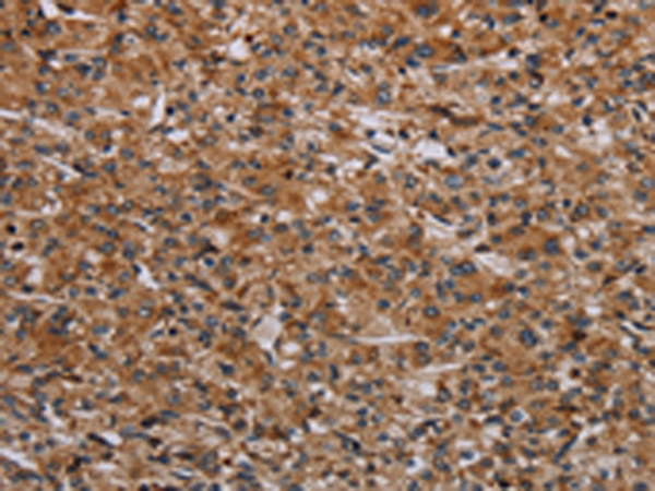 Rabbit Polyclonal Antibody to RPS6KB2