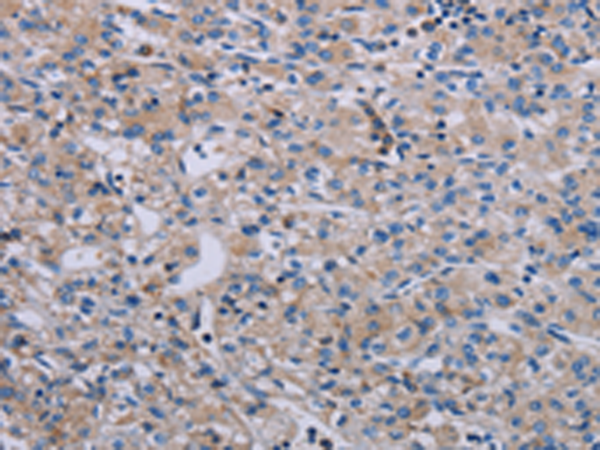 Rabbit Polyclonal Antibody to PAGE4