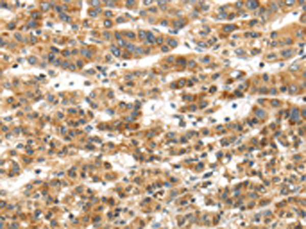 Rabbit Polyclonal Antibody to PAPPA