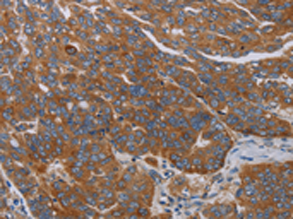 Rabbit Polyclonal Antibody to PARP10