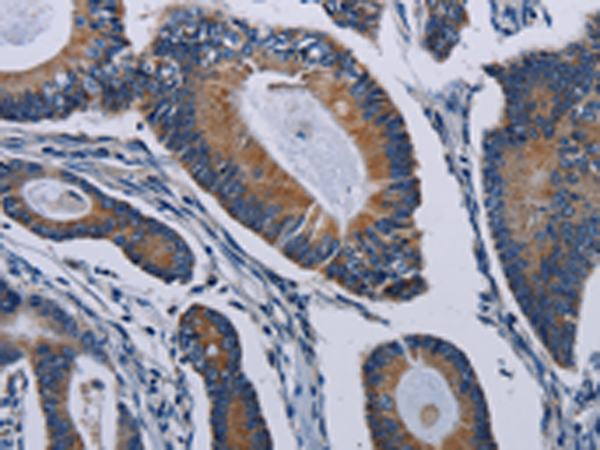 Rabbit Polyclonal Antibody to PCDHAC2
