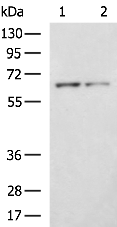 Rabbit Polyclonal Antibody to IVL