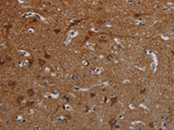 Rabbit Polyclonal Antibody to PCDHB15