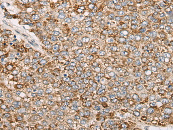 Rabbit Polyclonal Antibody to PCDHGB5