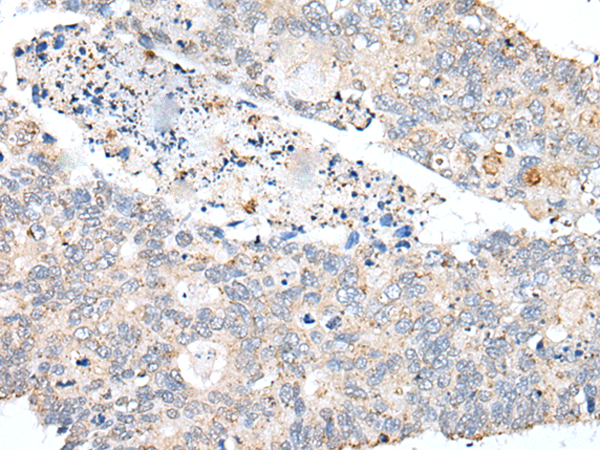 Rabbit Polyclonal Antibody to PDCD6IP