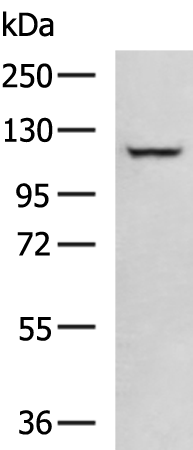 Rabbit Polyclonal Antibody to PDE5A