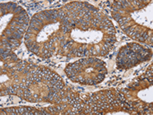 Rabbit Polyclonal Antibody to PDGFC