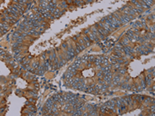 Rabbit Polyclonal Antibody to PYY