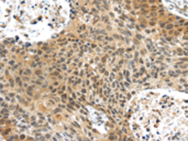 Rabbit Polyclonal Antibody to PLIN3