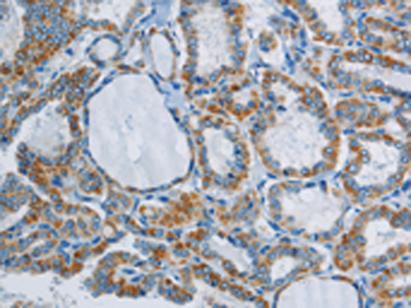 Rabbit Polyclonal Antibody to PPARGC1B